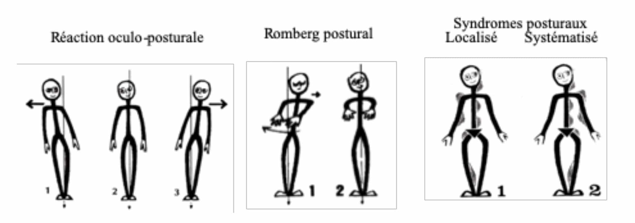 posturologie