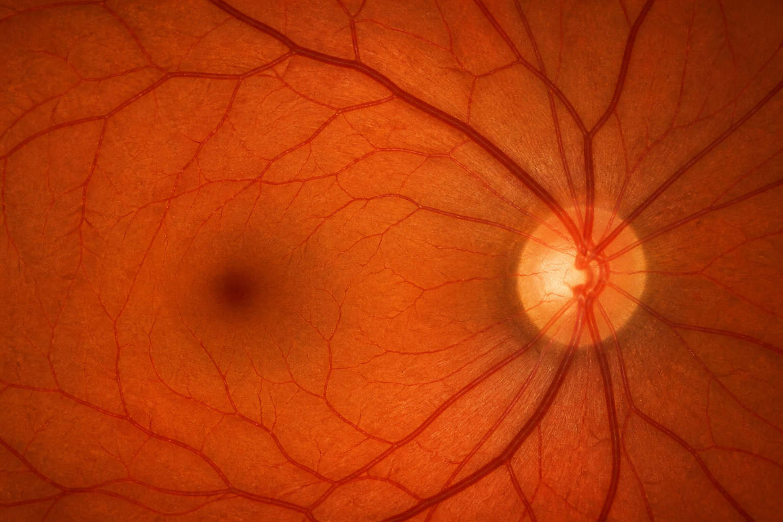 4 causes majeures expliquant le rétrécissement de votre champ visuel