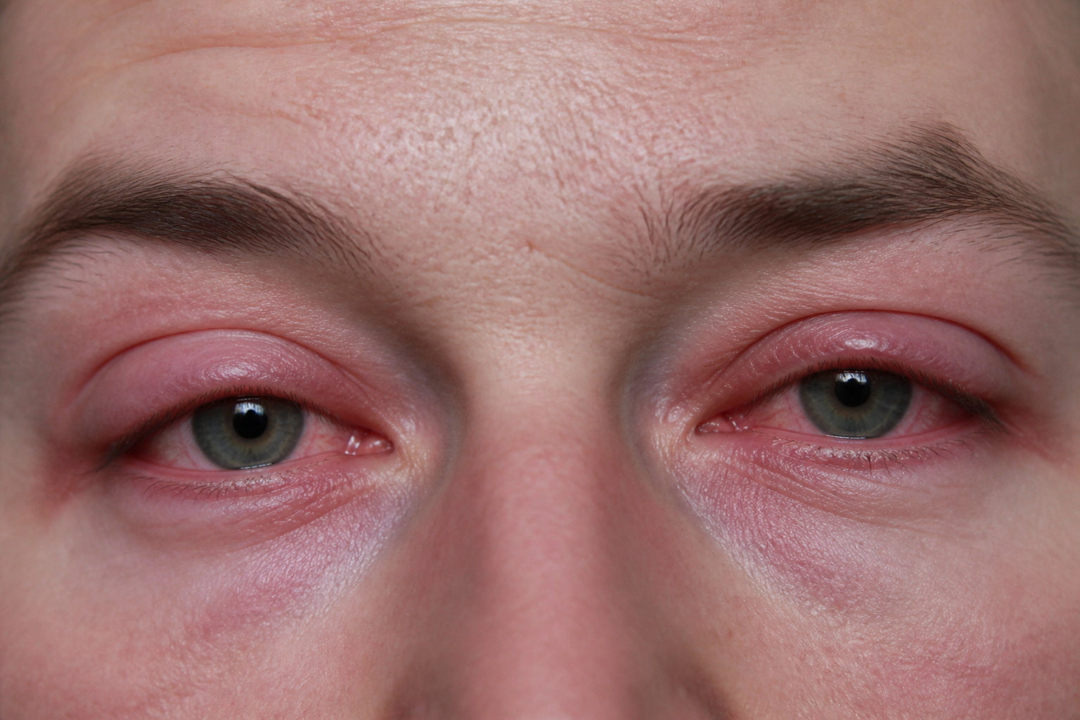 Pourquoi ressentez-vous cette sensation de sable dans les yeux ?